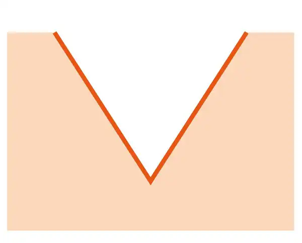 MicroNeedling