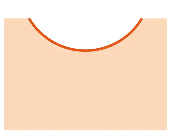 MicroNeedling